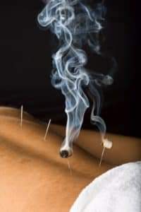 varma therapy in karaikudi