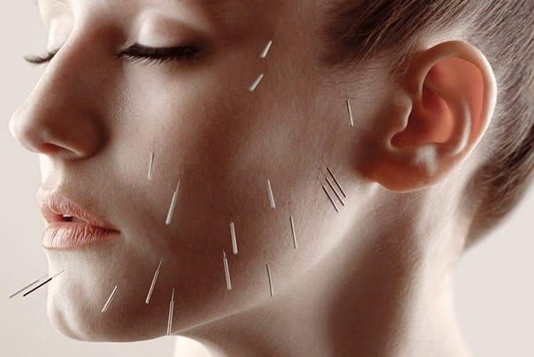 acupuncture in karaikudi